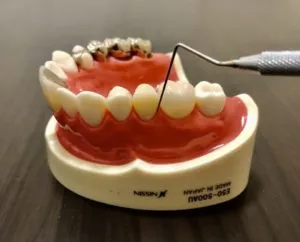 歯周病　検査