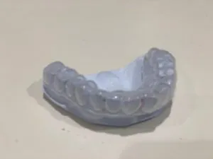 ナイトガード　マウスピース　歯ぎしり