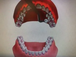 メンテナンス