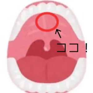 舌の位置