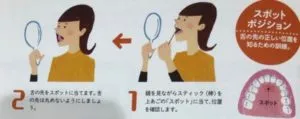 舌のトレーニング