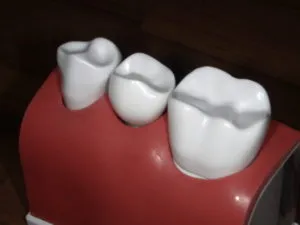 大臼歯